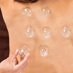 Master di Cupping primo livello